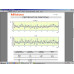 Профилометр Mitutoyo Surftest SJ-412